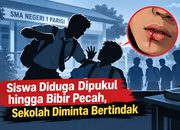 Siswa Diduga Dipukul hingga Bibir Pecah, Sekolah Diminta Bertindak